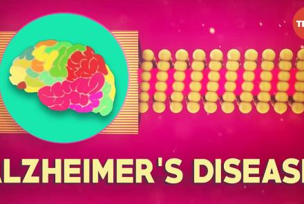 Embedded thumbnail for Alzheimer's Disease Video